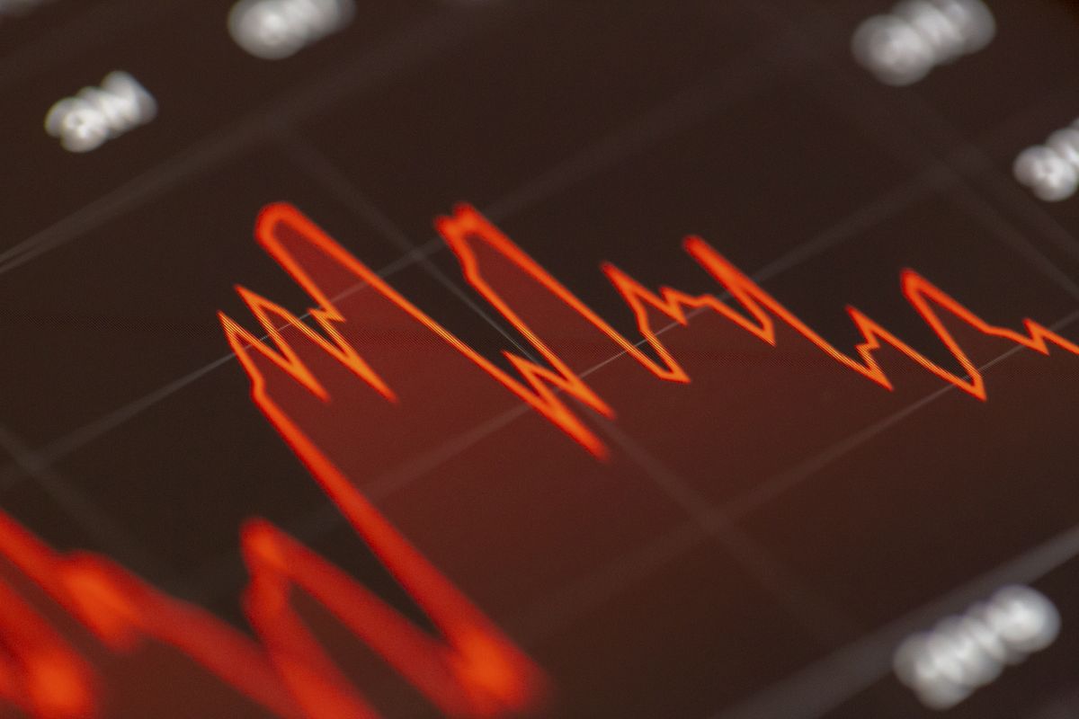 Balinalar Bu Coin'e Akın Ediyor! Sağlam Bir Stablecoin Karşınızda!